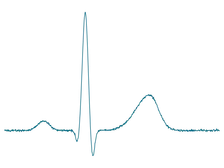 Animation of magnetic signal averaging